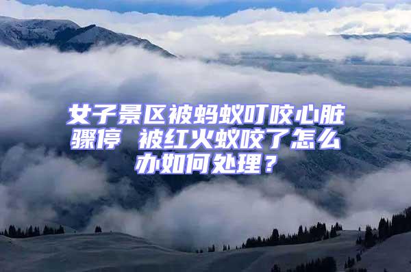 女子景區(qū)被螞蟻叮咬心臟驟停 被紅火蟻咬了怎么辦如何處理？