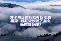 女子景區(qū)被螞蟻叮咬心臟驟停 被紅火蟻咬了怎么辦如何處理？